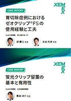 胃切除症例におけるゼオクリップ®FSの使用経験と工夫・蛍光クリップ留置の基本と有用性～