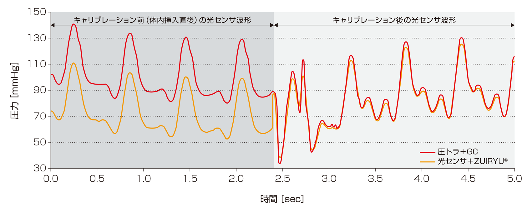 オートキャリブレーション