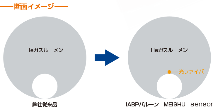 大口径セントラルルーメン