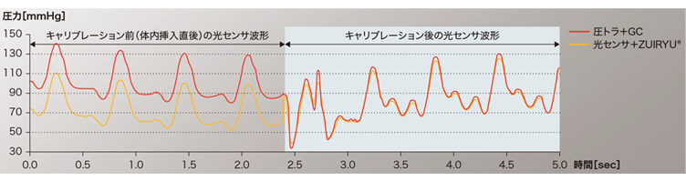 オートキャリブレーション