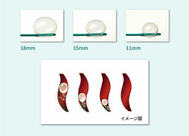 イメージ図