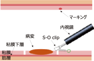 使用方法1